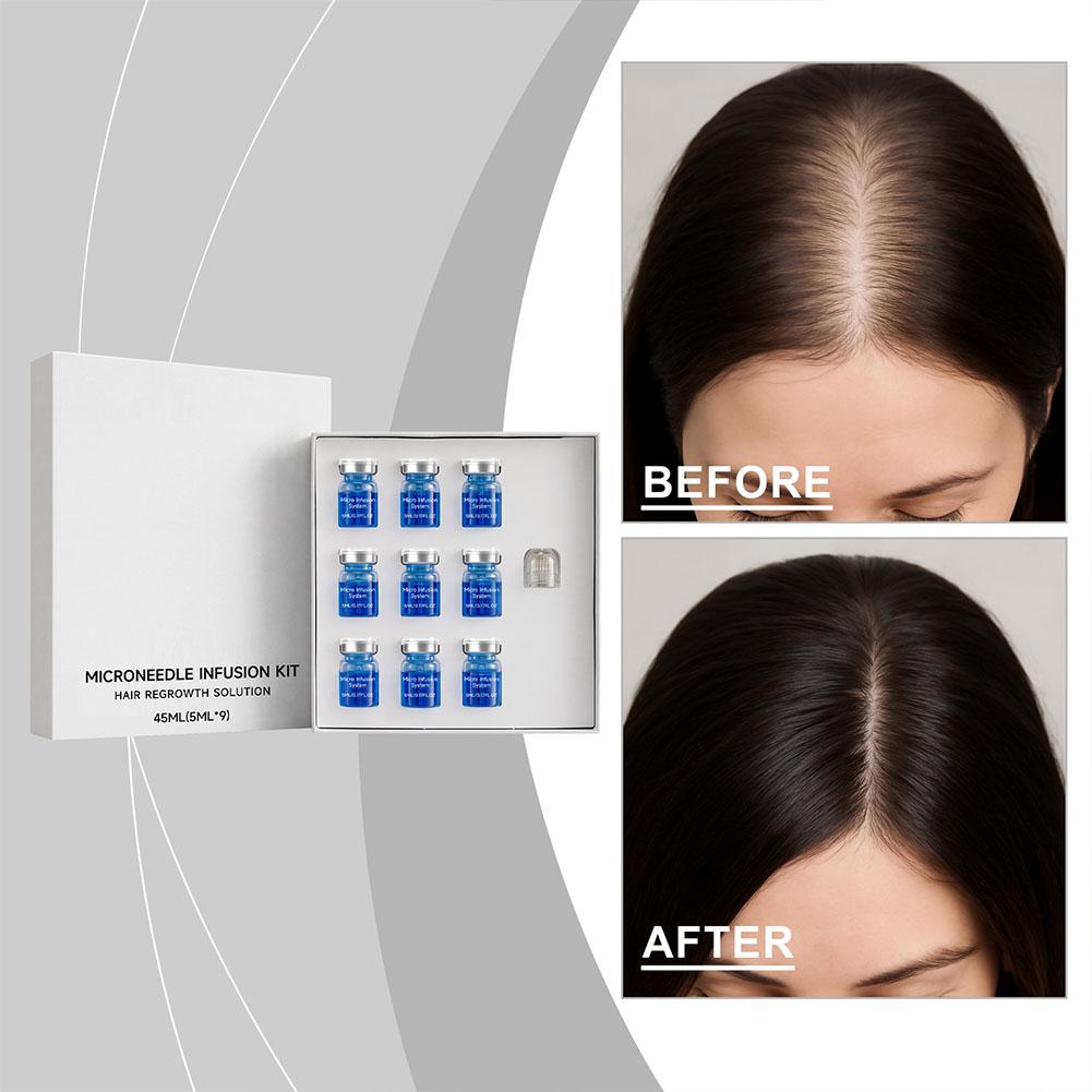 Set di Micro-Aghi con Siero Es - Hair Care Routine recensione e prezzo