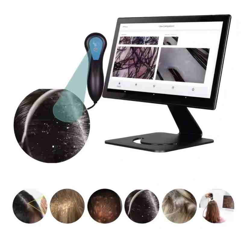 Nuovo Arrivo: Dispositivo AI p - Hair Care High End recensione e prezzo